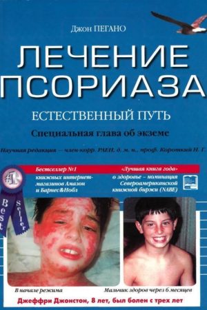 Лікування псоріазу. Природний шлях Джон Пегано